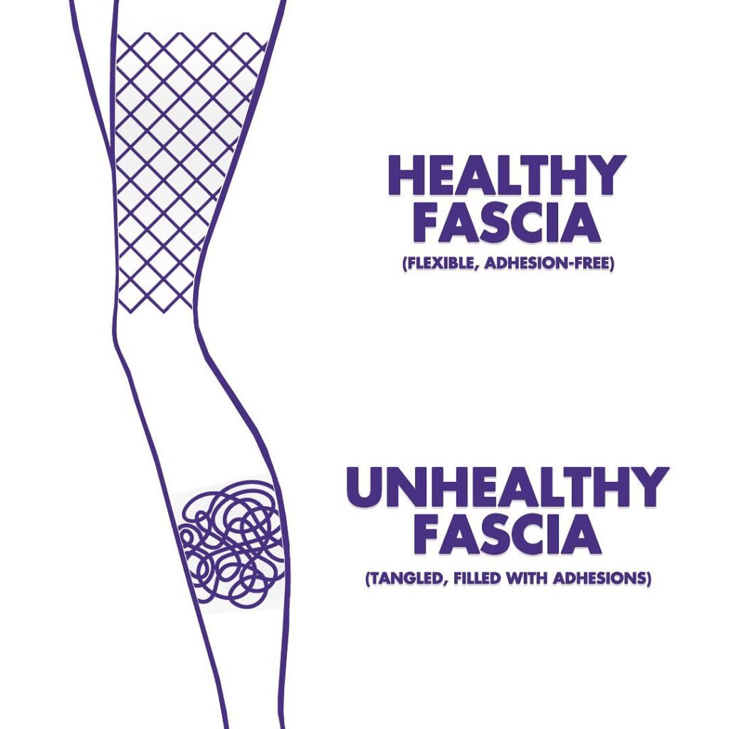 fascia stretching for resolving pain  